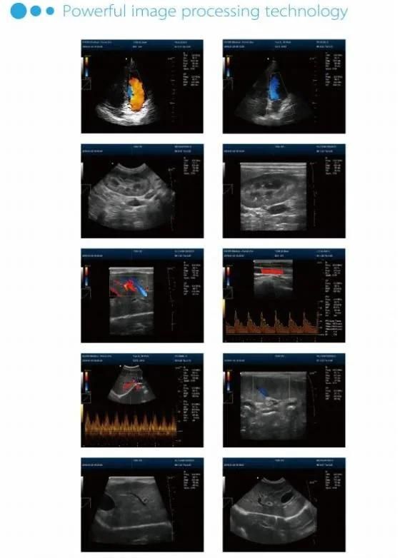 Vet Laptops Ultrasound Scanner Dcu50 Portable Ultrasound Scanner for Vet Moniter Factory Price Hospital Medical Equipment Animal Handheld Vet Color Doppler Port