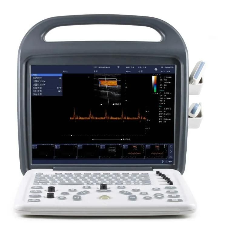 Vet Laptops Ultrasound Scanner Medical Equipment Supply Exp-5600 Veterinary Ultrasound Scanner Color Doppler Ultrasound Scanner