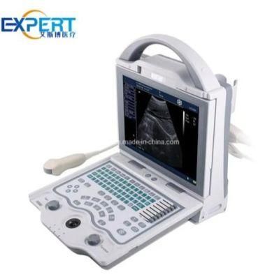 Medical Supply Vet Laptops Ultrasound Scanner Exp-5600 Portable Ultrasound Scanner for Vet Moniter