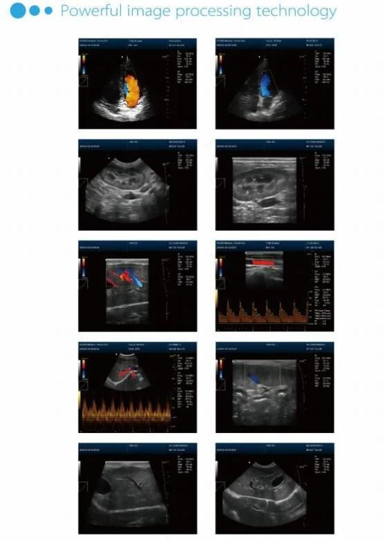 Factory Price Hospital Medical Ultrasound Scanner for Animal Pregnancy Vet Laptops Ultrasound Scanner Dcu50 Portable Ultrasound Scanner for Vet Moniter