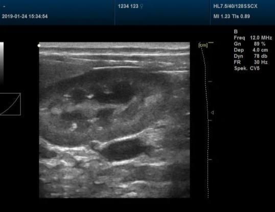 Animal Pregnancy Vet Laptops Ultrasound Scanner Dcu50 Portable Ultrasound Scanner for Vet Moniter