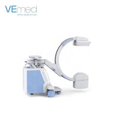 High Frequency Digital Mobile C Arm System X-ray