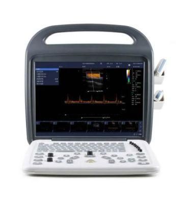 Animal Pregnancy Vet Laptops Ultrasound Scanner Dcu50 Portable Ultrasound Scanner for Vet Moniter