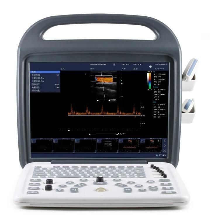 Medical Supply Vet Laptops Ultrasound Scanner Exp-5600 Portable Ultrasound Scanner for Vet Moniter