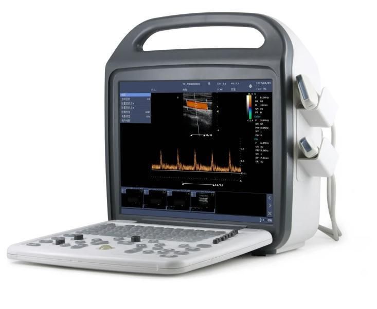 Medical Supply Vet Laptops Ultrasound Scanner Exp-5600 Portable Ultrasound Scanner for Vet Moniter