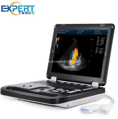 Factory Price Hospital Medical Ultrasound Scanner for Animal Pregnancy Vet Laptops Ultrasound Scanner Dcu50 Portable Ultrasound Scanner for Vet Moniter