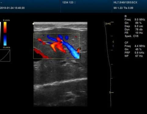 Scanner for Animal Pregnancy Vet Laptops Ultrasound Scanner Dcu50 Portable Ultrasound Scanner for Vet Moniter