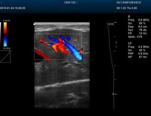 Medicine Equipment Ultrasound Scanner for Animal Pregnancy Vet Laptops